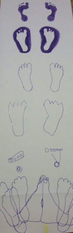 feet-3